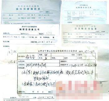 男子患癌症竟被误诊角化病